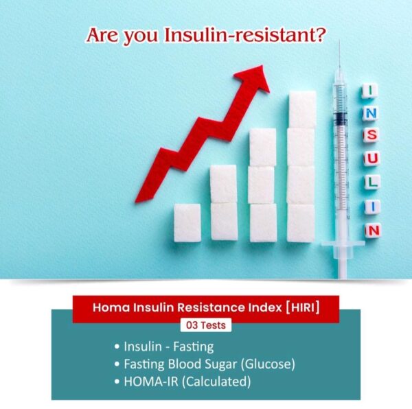 HOMA INSULIN RESISTANCE INDEX