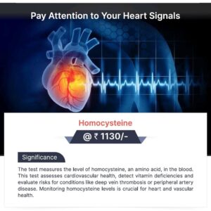 HOMOCYSTEINE