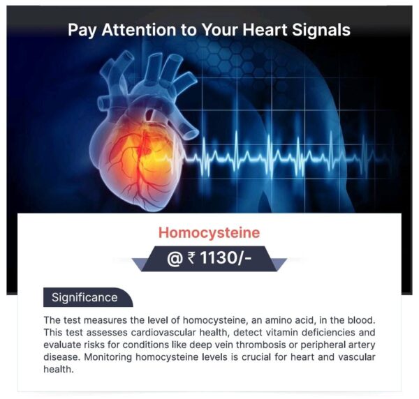 HOMOCYSTEINE