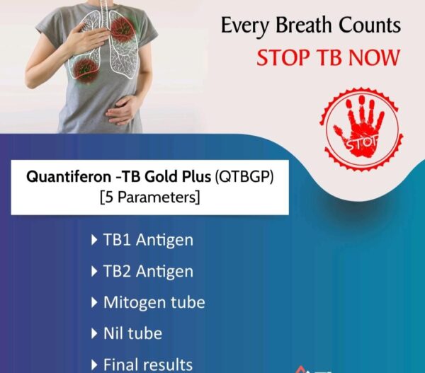 QUANTIFERON -TB GOLD PLUS