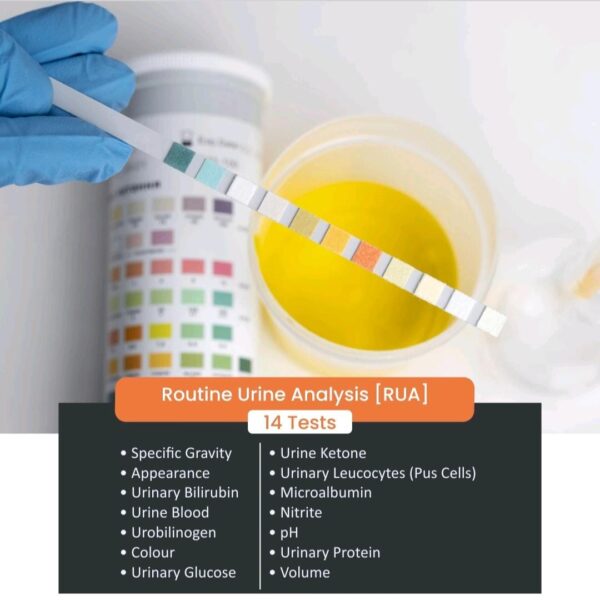 ROUTINE URINE ANALYSIS