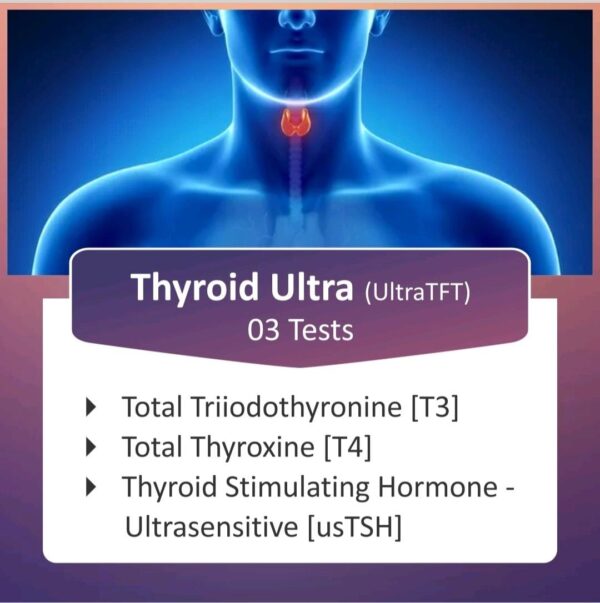 T3-T4-USTSH