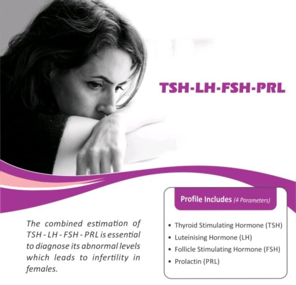TSH-LH-FSH-PRL
