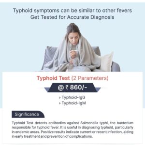 TYPHOID TEST