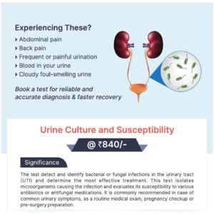 URINE CULTURE AND SUSCEPTIBILITY