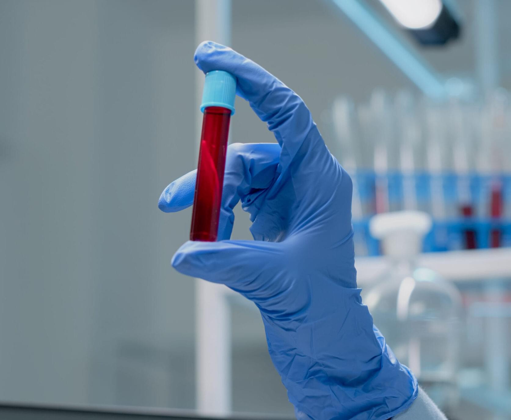 WIDAL TUBE AGGLUTINATION