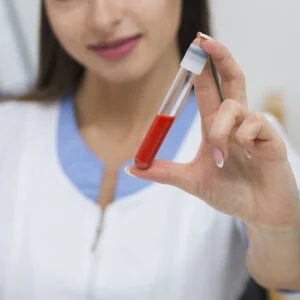 1,5 ANHYDROGLUCITOL